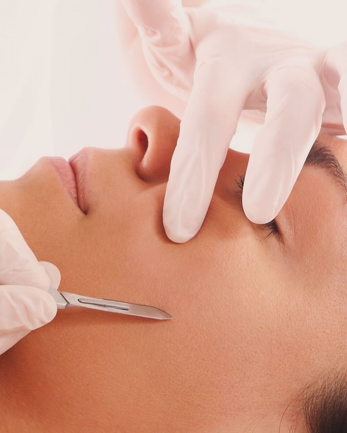 Prestation dermaplaning - Kayliss Beauty institut de beauté à Cagnes sur Mer